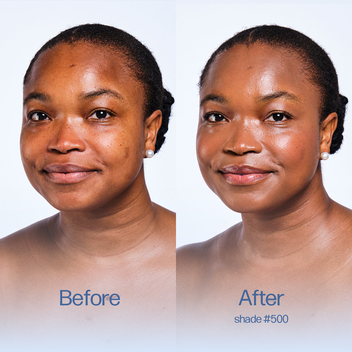 Before and after comparison of a woman's face with visible skin improvement on a white background. Shade 500