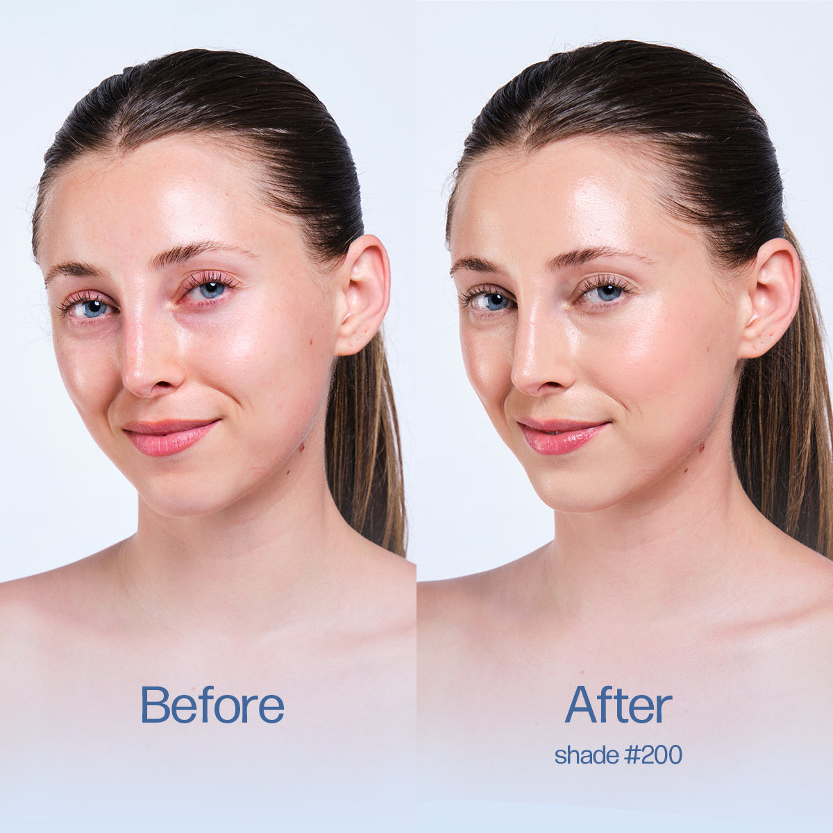 Before and after comparison of a woman's face with visible skin improvement on a white background. Shade 200