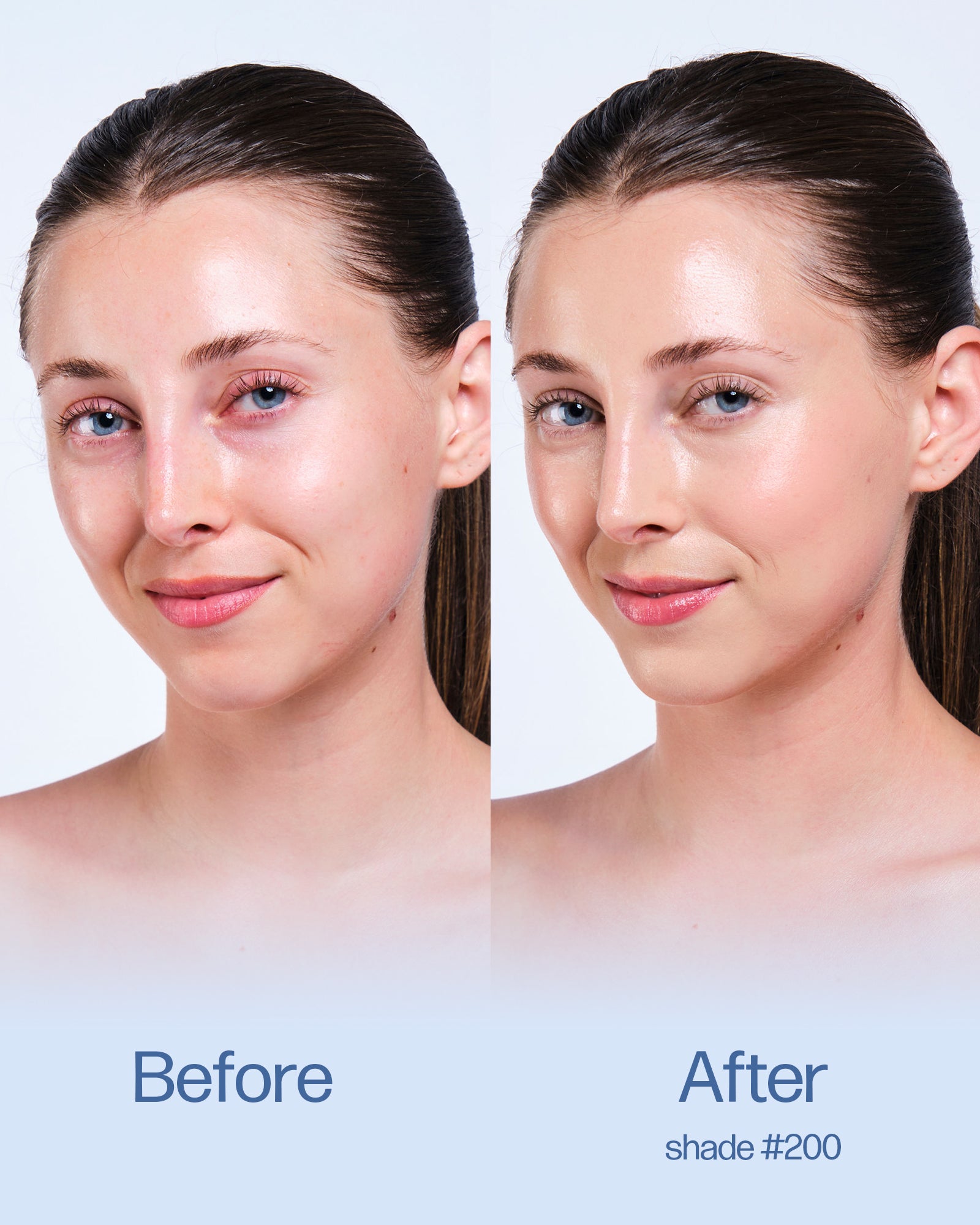 Before and after comparison of a woman's face with visible skin treatment results on a plain background. Shade 200