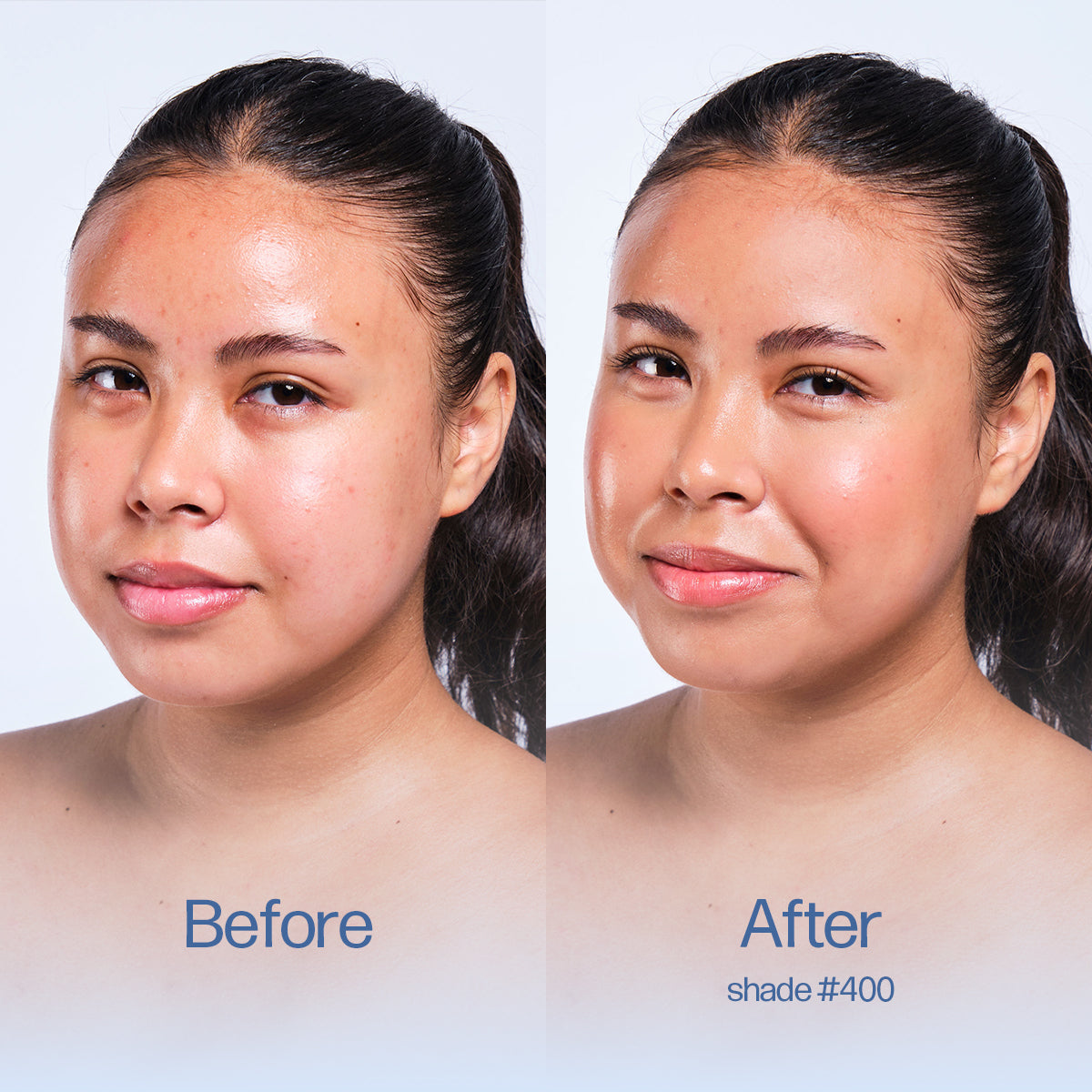 Before and after comparison of a woman's face with visible skin improvement. Shade 400